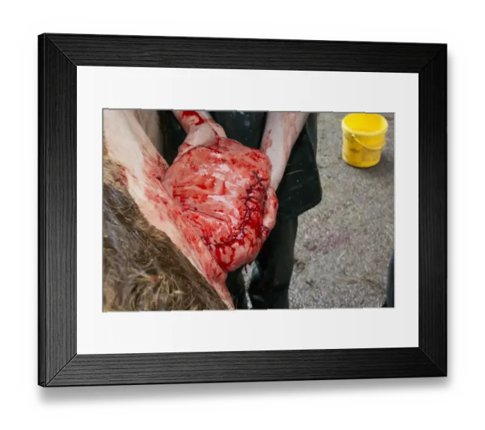 Framed Print : Cattle farming, vet stitching up cow uterus after caesarean calving, England, March Framed Print : Cattle farming, vet stitching up cow uterus after caesarean calving, England, March