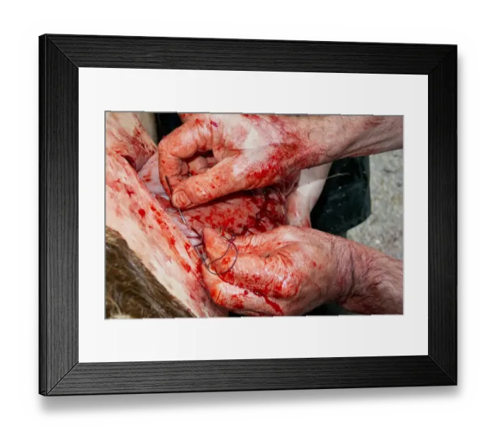 Framed Print : Cattle farming, vet stitching up cow uterus after caesarean calving, England, March Framed Print : Cattle farming, vet stitching up cow uterus after caesarean calving, England, March