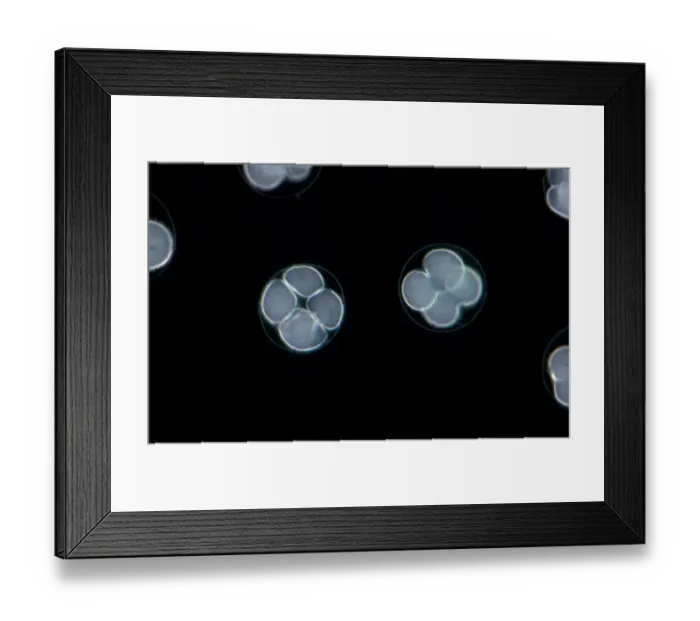 Framed Print : Echinus esculentus, the European edible sea urchin or common sea urchin, is a species of marine invertebrate in Framed Print : Echinus esculentus, the European edible sea urchin or common sea urchin, is a species of marine invertebrate in