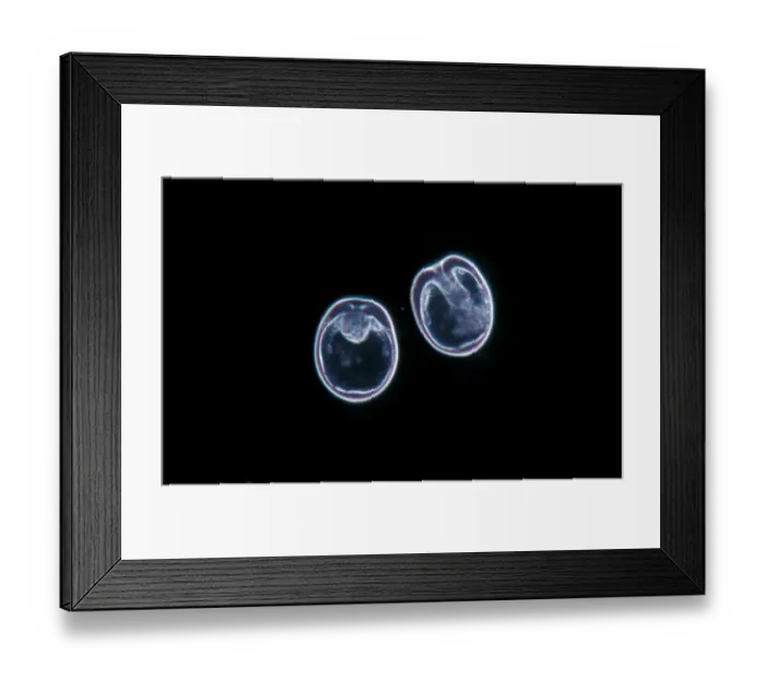 Framed Print : Echinus esculentus, the European edible sea urchin or common sea urchin, is a species of marine invertebrate in Framed Print : Echinus esculentus, the European edible sea urchin or common sea urchin, is a species of marine invertebrate in