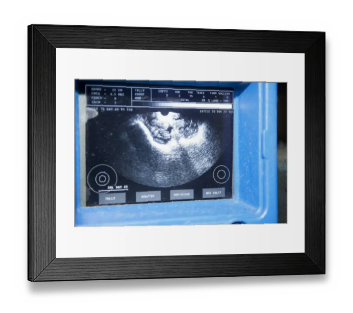 Framed Print : Sheep farming, ultrasound scanner screen, scanning ewes during early stage pregnancy to see how many lambs they are Framed Print : Sheep farming, ultrasound scanner screen, scanning ewes during early stage pregnancy to see how many lambs they are