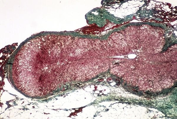 Adrenal cortex, light micrograph C015  /  6417