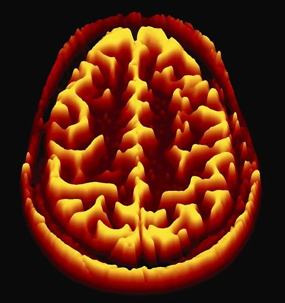 Brain scan, MRI scan, heightmap F006  /  7078