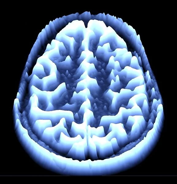 Brain scan, MRI scan, heightmap F006  /  7080