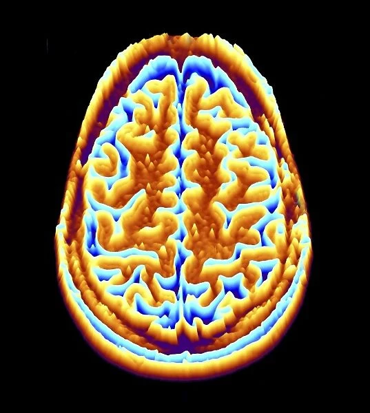 Brain scan, MRI scan, heightmap F006  /  7091