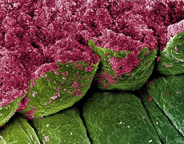Coloured SEM of iris epithelial cells of the eye