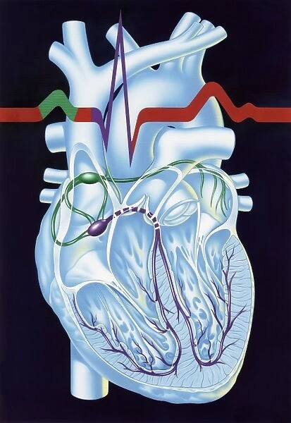 Electrical conduction in the heart, artwork