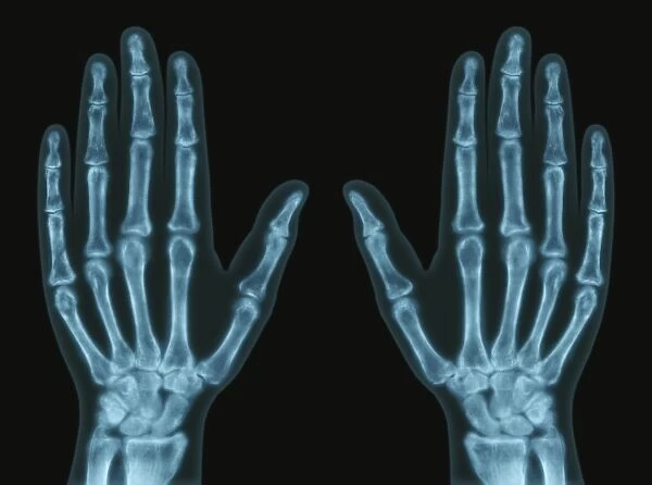 Hands, X-ray F006  /  8801