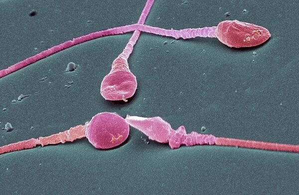 Human sperm cells, SEM