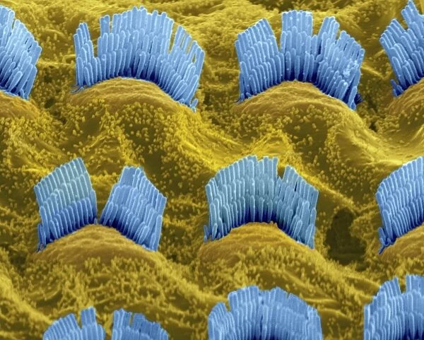 Inner ear hair cells, SEM C014  /  4852