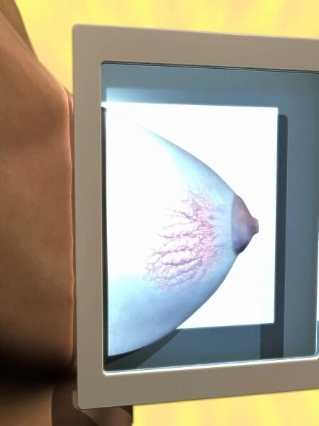 Mammogram, conceptual image