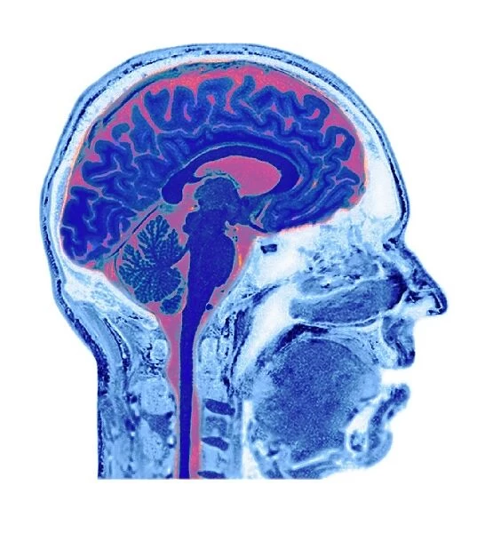 Normal human brain, MRI scan C016  /  8847