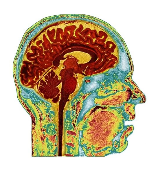Normal human brain, MRI scan C016  /  8849