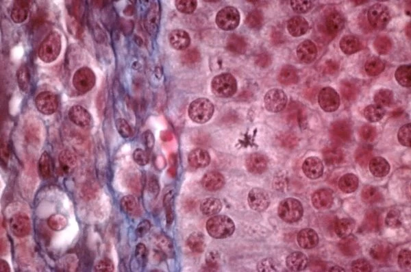 Ovarian follicle tissue, light micrograph