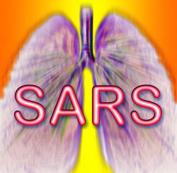 Severe acute respiratory syndrome (SARS)
