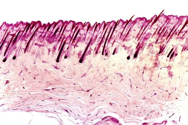 Skin tissue, light micrograph