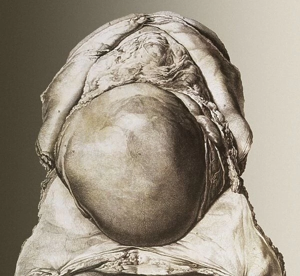Uterus of a pregnant woman