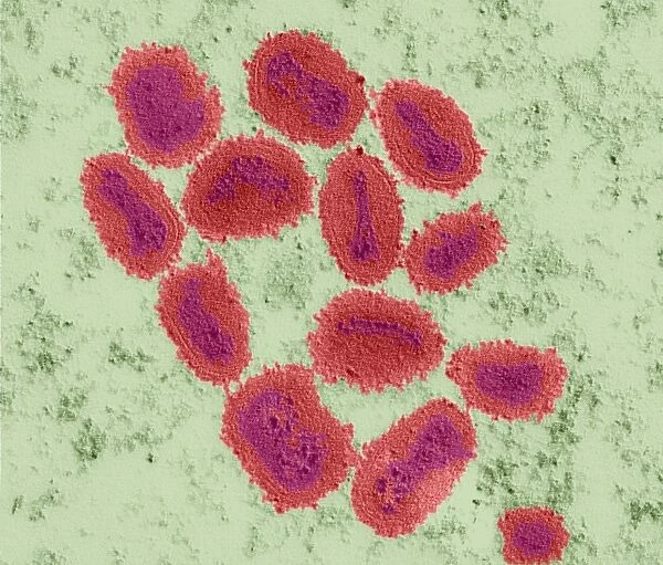 Vaccinia virus particles, TEM