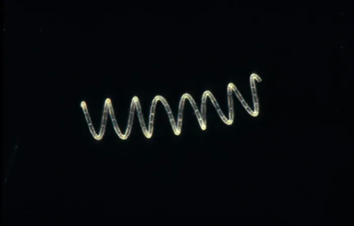 Framed Print : Plankton - Diatom (Rhizosolenia stolterfothii) Individual diatoms unite to form