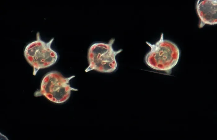 Framed Print : Plankton - Dinoflagellate (Peridinium depressum) x 43 Framed Print : Plankton - Dinoflagellate (Peridinium depressum) x 43