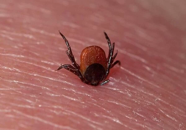 Tick (Acarina sp. ) adult, feeding, on human skin with inflammation, England, june