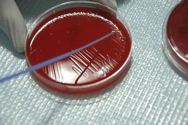 Staphylococcus Bacteria from human skin grown on agar