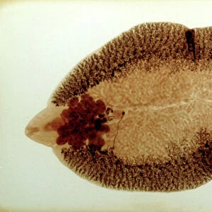 Liver Fluke, microscope slide preparation of the whole animal