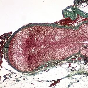 Adrenal cortex, light micrograph C015 / 6417