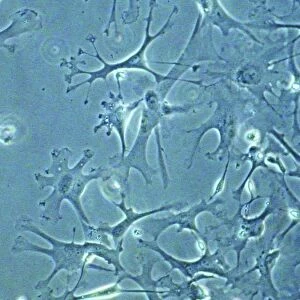 Astrocyte nerve cells