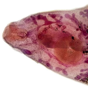 Beef liver fluke, light micrograph
