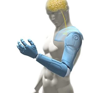 Bionic arm, artwork