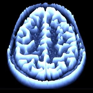 Brain scan, MRI scan, heightmap F006 / 7080