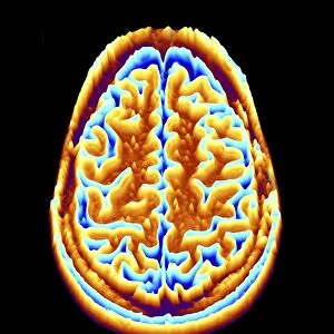 Brain scan, MRI scan, heightmap F006 / 7091