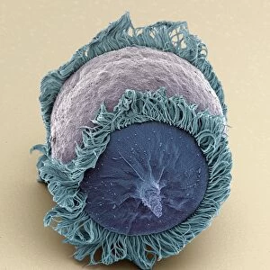 Didinium ciliate protozoan, SEM C019 / 0237