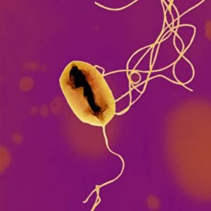 E. coli bacterium strain O157: H7, TEM