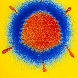 False-colour TEM of an Adenovirus