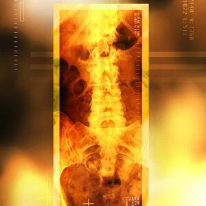 Healthy lower back, X-ray