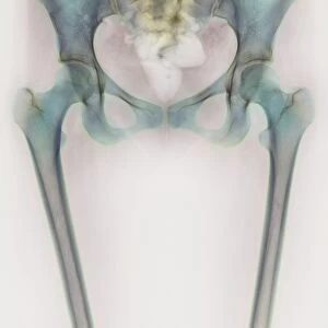 Hip bones, X-ray