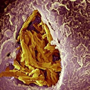 Macrophage engulfing tuberculosis vaccine