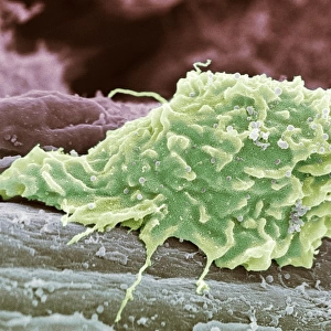 Macrophage white blood cell, SEM