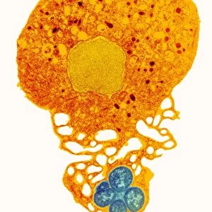 Neutrophil and trapped bacteria, TEM