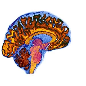 Normal human brain, MRI scan C016 / 8834