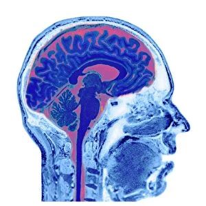 Normal human brain, MRI scan C016 / 8847