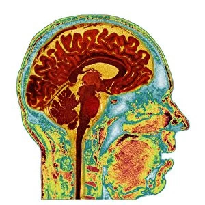 Normal human brain, MRI scan C016 / 8849