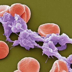 Red blood cells and platelets, SEM
