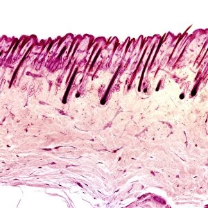 Skin tissue, light micrograph