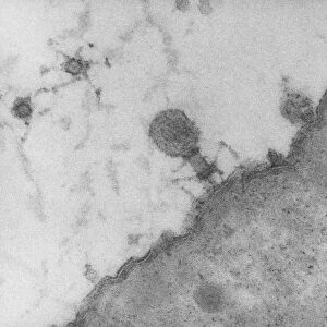 TEM of T4 bacteriophage infecting E. coli