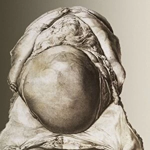 Uterus of a pregnant woman
