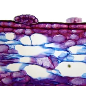 Venus flytrap leaf, light micrograph