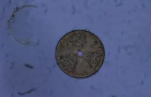 acrinoptychus senarius living in the plankton x130 magnification